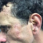 Capriles herido