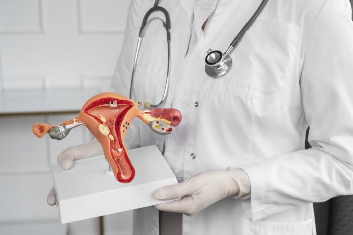 Cáncer de cuello uterino Cáncer